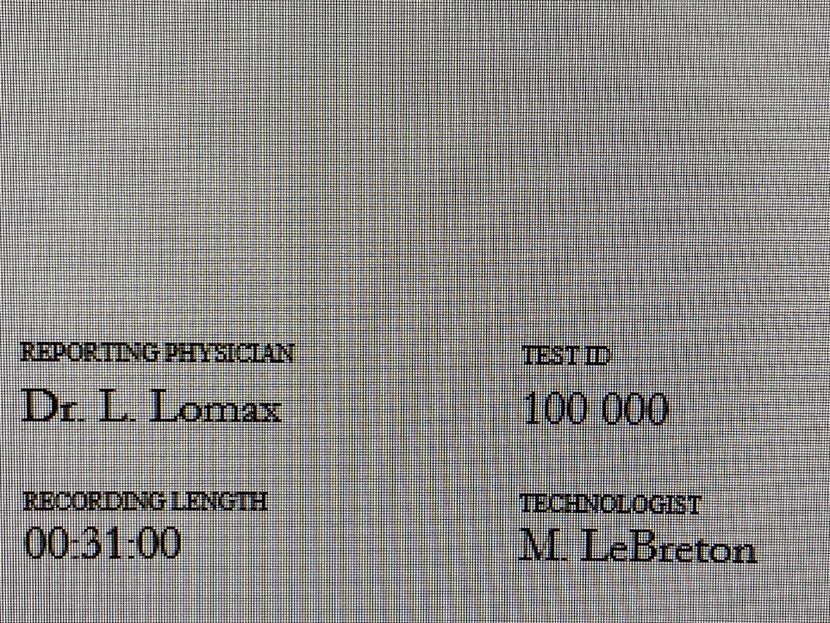 Lysa Lomax (she/her) (@lysalomax) on Twitter photo The EEG lab at KHSC recorded our 100,000th EEG today!!! 🧠🥳🤜🤛 ⚡️ What a milestone. Thank you to our amazing techs, nurses, admin assistants and epileptologists. What a team! <a href="/KingstonHSC/">KingstonHSC</a> <a href="/SEAMOKingston/">SEAMO: Southeastern Ontario Academic Medical Org.</a> <a href="/DrGavinWinston/">Gavin Winston</a> The EEG lab at KHSC recorded our 100,000th EEG today!!! 🧠🥳🤜🤛 ⚡️ What a milestone. Thank you to our amazing techs, nurses, admin assistants and epileptologists. What a team! <a href="/KingstonHSC/">KingstonHSC</a> <a href="/SEAMOKingston/">SEAMO: Southeastern Ontario Academic Medical Org.</a> <a href="/DrGavinWinston/">Gavin Winston</a>
