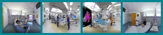 Europace Editor-in-Chief (@europaceeic) on Twitter photo #EUROPACE_fresh_of_the_press
360° #Virtual reality #VR to improve patient education &reduce anxiety towards #AF ablation
📖bit.ly/3I3Npby
<a href="/AstridHermans/">Astrid Hermans</a> <a href="/BetzKonstanze/">Konstanze Betz</a> <a href="/kvernooy/">Kevin Vernooy</a> <a href="/Dominik_Linz/">Dominik Linz</a> <a href="/BobWeijs/">Bob Weijs</a>
Editorial
bit.ly/3HFGDqY <a href="/BruiningNico/">Nico Bruining EiC EHJ Digital Health</a>
<a href="/ESC_Journals/">European Society of Cardiology Journals</a> #EUROPACE_fresh_of_the_press
360° #Virtual reality #VR to improve patient education &reduce anxiety towards #AF ablation
📖bit.ly/3I3Npby
<a href="/AstridHermans/">Astrid Hermans</a> <a href="/BetzKonstanze/">Konstanze Betz</a> <a href="/kvernooy/">Kevin Vernooy</a> <a href="/Dominik_Linz/">Dominik Linz</a> <a href="/BobWeijs/">Bob Weijs</a>
Editorial
bit.ly/3HFGDqY <a href="/BruiningNico/">Nico Bruining EiC EHJ Digital Health</a>
<a href="/ESC_Journals/">European Society of Cardiology Journals</a>