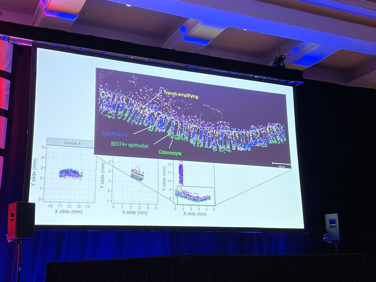 Daniela_Bezdan's tweet image. @mason_lab @nanostringtech dropping the news of the SAHA project, detailed resolution in #spatialgenomics with 120-plex CosMx SMI @agbt #agbt23