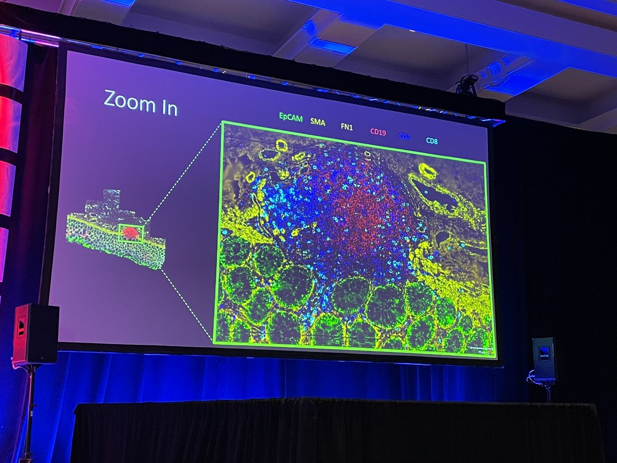 Daniela_Bezdan's tweet image. @mason_lab @nanostringtech dropping the news of the SAHA project, detailed resolution in #spatialgenomics with 120-plex CosMx SMI @agbt #agbt23