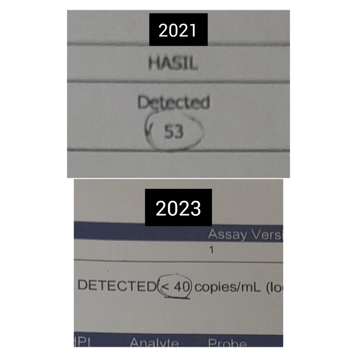 Alhamdulillah.. semoga terus turun sampe undetected..