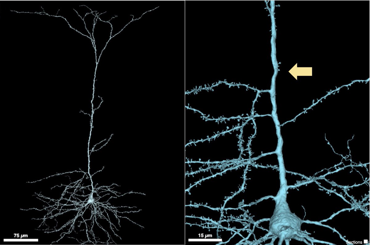 HaniehFalahati's tweet image. This last min #EM_Monday, I will share a beautiful pyramidal neuron I found. What was surprising to me is that for hundreds of microns, there are no dendritic spines in its apical dendrite, so for a while all synapses are onto the dendritic shaft. Arrow shows the 1st spine. (1/n)