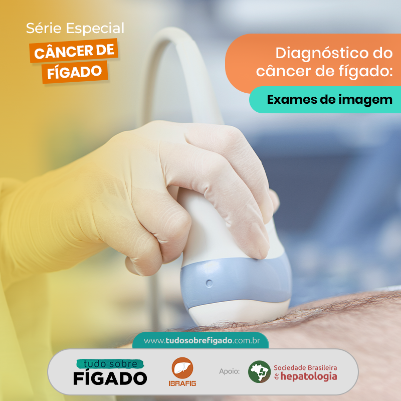 tudosobrefigado's tweet photo. 👉O hepatocarcinoma (CHC) é o câncer primário do fígado.
🔹A melhoria das técnicas de imagem permite que os médicos diagnostiquem com precisão o CHC sem confirmação por biópsia, na maioria dos casos.
#cancerdefigado #cirrose #figado https://t.co/ETWd9n9oc0