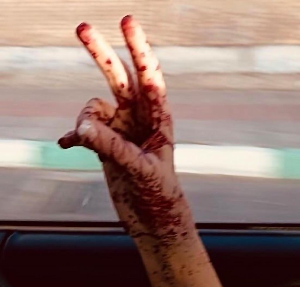 yasesami1's tweet photo. اره حرومزاده من هنوز زنده ام و تا آخرش هستم ✌🏻
من ک زبونم سرخه و سرم سبز ی سفید کمه میکنم کفن تن مارو از چی میترسونی حرومی 😎🔥
سلام ب همگی من برگشتم🤝🏼
و ممنون از کسایی ک حالمو پرسیدن زنده ام ✌🏻
#مهسا_امینی
#اعتصابات_سراسری https://t.co/Z9Rsr2QWO7