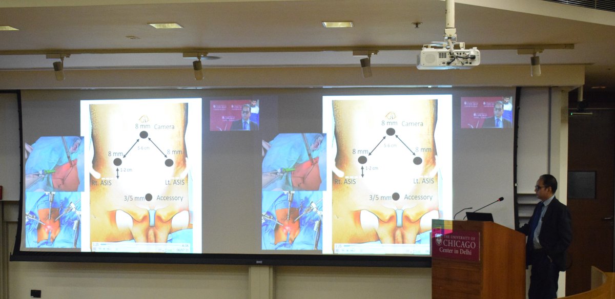 UChicago Delhi (@uchidelhi) on Twitter photo Feb 6: Training cum workshop organized by <a href="/UChiDelhi/">UChicago Delhi</a>, in partnership with <a href="/aiims_newdelhi/">AIIMS, New Delhi 🇮🇳</a> and <a href="/Fortis/">Fortis</a> Gurgaon on "State of the Art: Pediatric Robotic CME Program ", led by Prof. Mohan Gundeti, Professor of Pediatric Urology, <a href="/uchicagosurgery/">UChicago Surgery</a> Feb 6: Training cum workshop organized by <a href="/UChiDelhi/">UChicago Delhi</a>, in partnership with <a href="/aiims_newdelhi/">AIIMS, New Delhi 🇮🇳</a> and <a href="/Fortis/">Fortis</a> Gurgaon on "State of the Art: Pediatric Robotic CME Program ", led by Prof. Mohan Gundeti, Professor of Pediatric Urology, <a href="/uchicagosurgery/">UChicago Surgery</a>