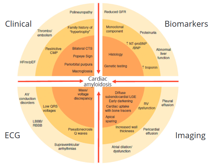 gbiondizoccai's tweet photo. The revolution of ATTR amyloidosis in cardiology: certainties, gray zones and perspectives, by the late Claudio Rapezzi et al
https://t.co/NXNp8MzqW4
#MinervaCardiologyAngiology https://t.co/lp4gLEJ2F3