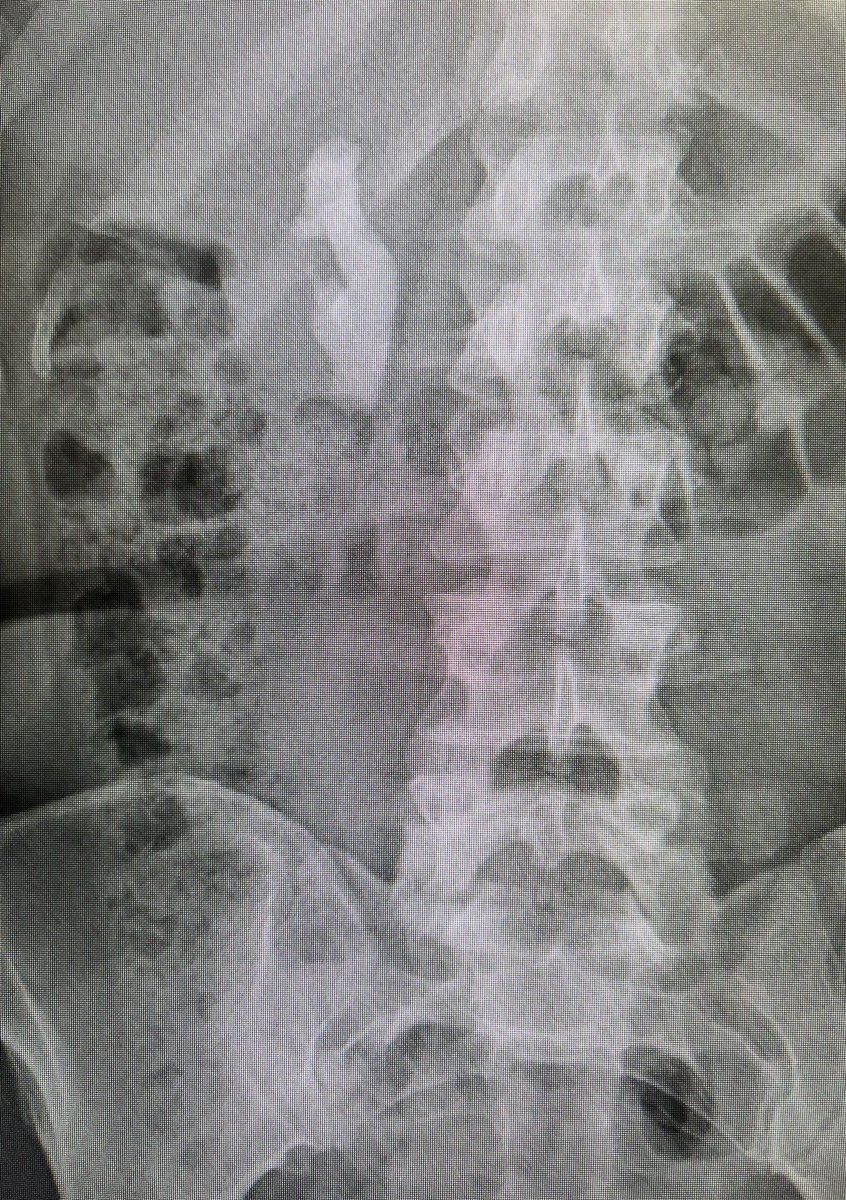 Oriol Angerri tweet media