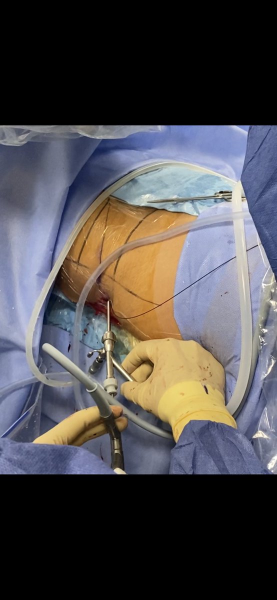 Oriol Angerri tweet media