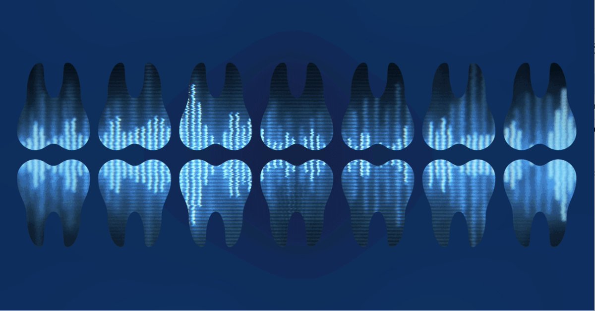 Advanced AI speech-to-text voice dictation that records perio exams and clinical notes for hygienists and dentists. Learn More: bit.ly/3QlzYoT

#dentrixascend #dentrixascendvoice