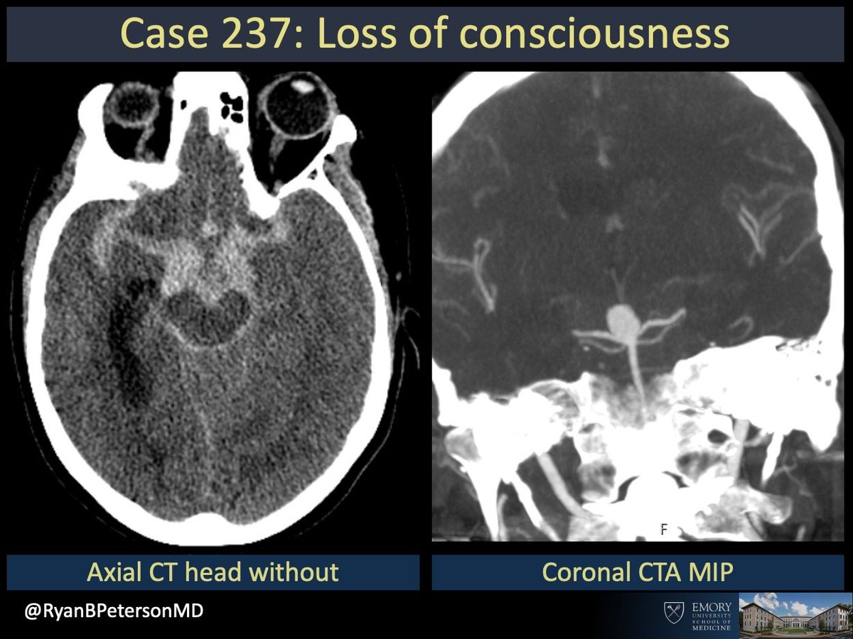 Ryan B Peterson 🇸🇪 tweet media
