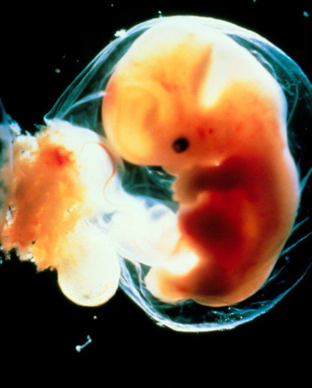 McAvoyDawn's tweet photo. 6 weeks #AlwaysHuman #BothLivesMatter https://t.co/rpuRTAnn6U