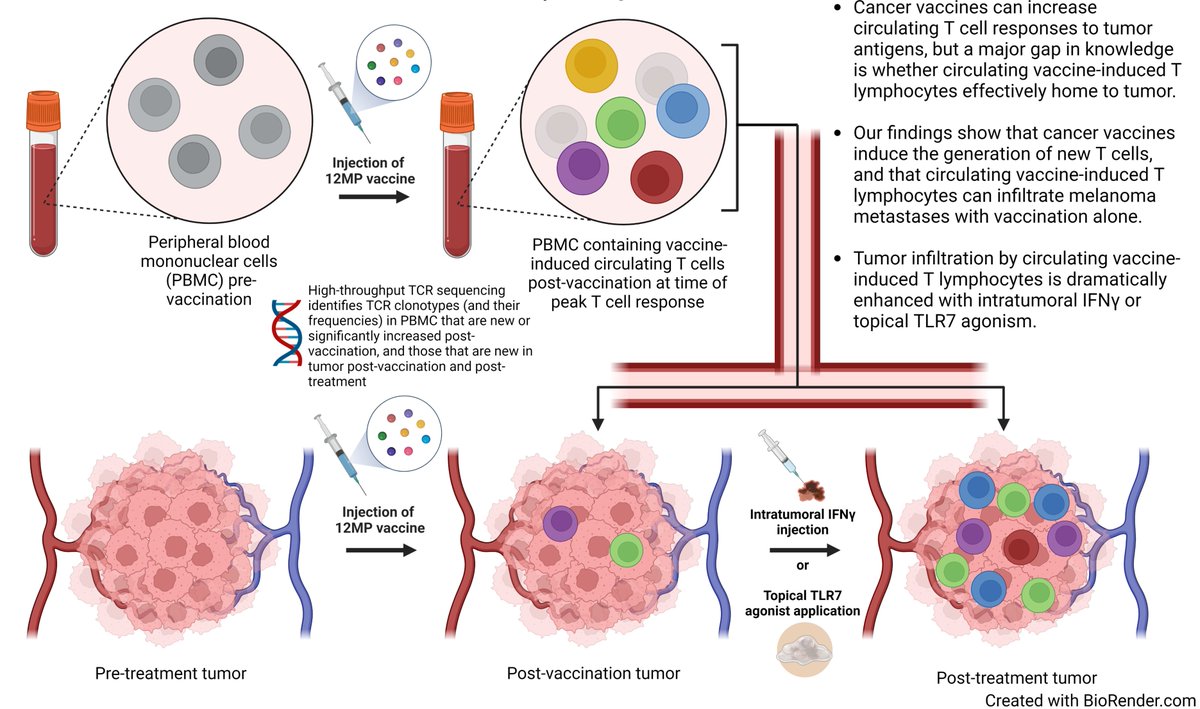 Journal for ImmunoTherapy of Cancer (@jitcancer) on Twitter photo New #JITC article: Intratumoral IFN-γ or topical TLR7 agonist promotes infiltration of melanoma metastases by T lymphocytes expanded in the blood after cancer vaccine bit.ly/40wZnl2 <a href="/TranChristineA/">Christine Tran, MD</a> <a href="/MaxMeneveauMD/">Max Meneveau, MD, MS</a> <a href="/CraigSlingluff/">Craig Slingluff</a> New #JITC article: Intratumoral IFN-γ or topical TLR7 agonist promotes infiltration of melanoma metastases by T lymphocytes expanded in the blood after cancer vaccine bit.ly/40wZnl2 <a href="/TranChristineA/">Christine Tran, MD</a> <a href="/MaxMeneveauMD/">Max Meneveau, MD, MS</a> <a href="/CraigSlingluff/">Craig Slingluff</a>