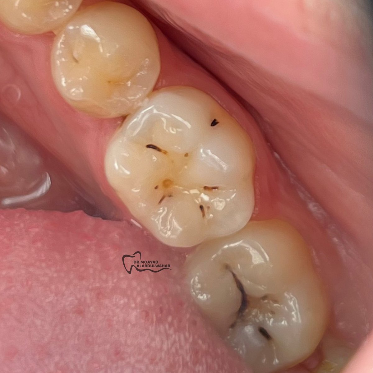 مؤيد tweet media