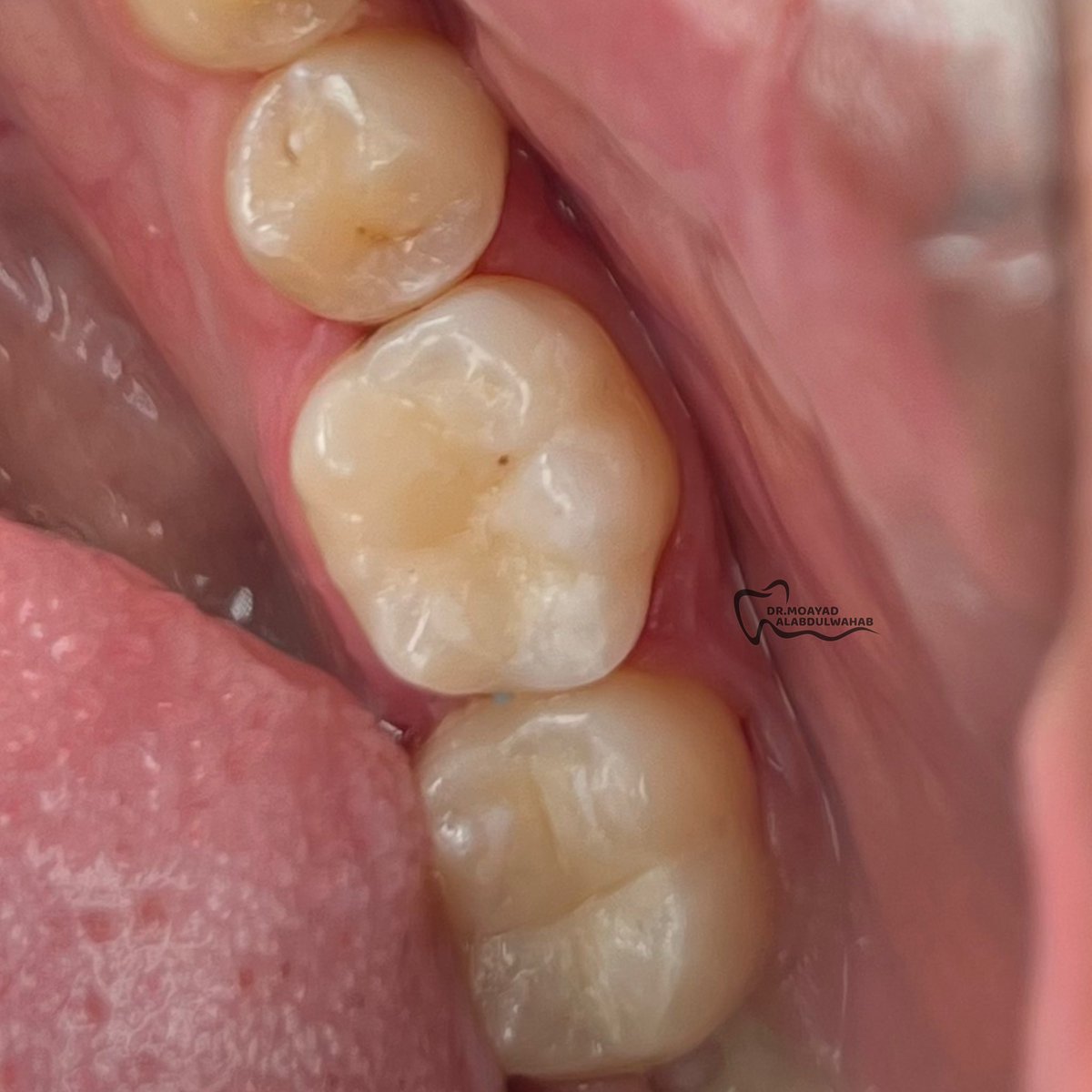 مؤيد tweet media