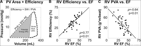 asaiojournal's tweet photo. Read the #OpenAccess #EditorsPick in February Issue
Pressure Volume Loop Analysis of the Right Ventricle in Heart Failure With Computed Tomography
https://t.co/LEg9kQ7i4g
@ContijochResLab 

#RVEF #PVLoops #HeartFailure https://t.co/ylJHeQaldZ