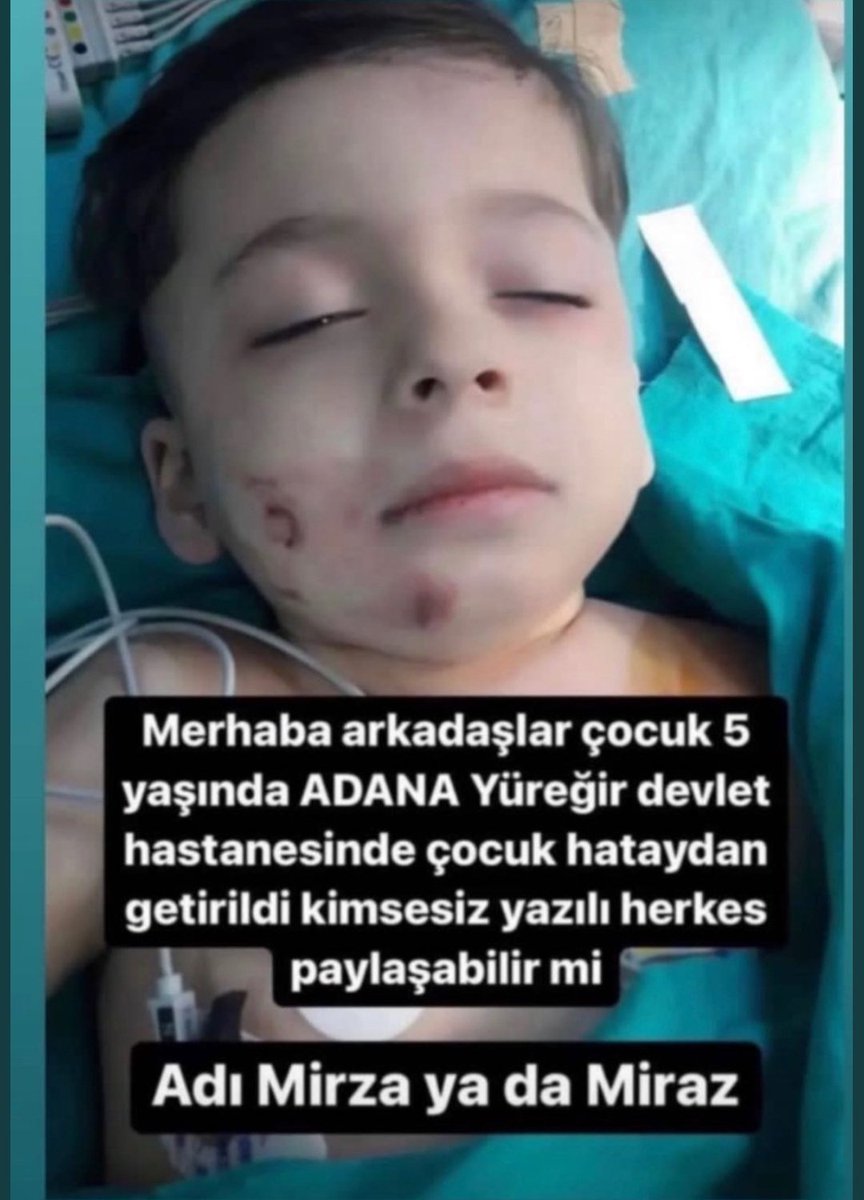 TR_Haber_Ajansi's tweet photo. 🔴ÇOK ACİL RT EDELİM ❗ https://t.co/hPupFY4aAL