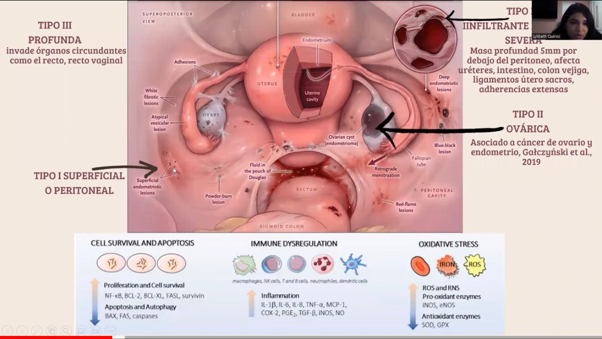 Ya está en YouTube la grabación de la charla del Estudio de Nutrición en el cual participaron socias de Aenpa, no se lo pierdan! #Endometriosis #Adenomiosis #Nutrición #Alimentación #ControldelDolor  youtu.be/c90bsCgGPMw