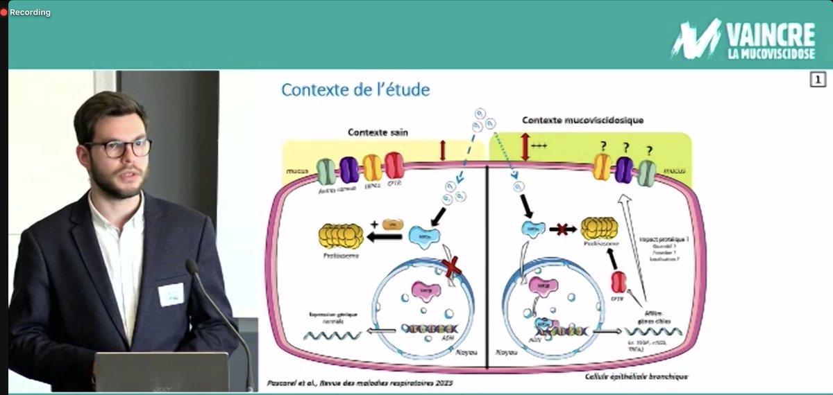Genevieve_Hery's tweet photo. #CFJC2023 Activité physique, anoxie, infections aspergillaires ... La recherche en #mucoviscidose remet les compteurs à zéro (ou presque) à l'ère des modulateurs ! Bravo aux jeunes chercheurs de Reims, Tours, Nice (et d'ailleurs) pour s'être emparés de cette thématique. https://t.co/h0YsNqRYM1