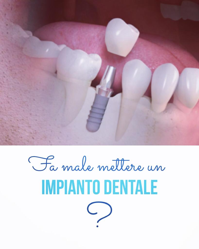 r_monguzzi's tweet photo. La domanda che tanto viene posta dal paziente: “Dottore mettere un impianto fa male?” ASSOLUTAMENTE NO! Durante l’intervento chirurgico, al paziente viene effettuata un’anestesia locale in modo da non poter sentire nulla durante tutta l’operazione.
☎️ 0226145657 📱 388840209 https://t.co/jWd61UC0Rn
