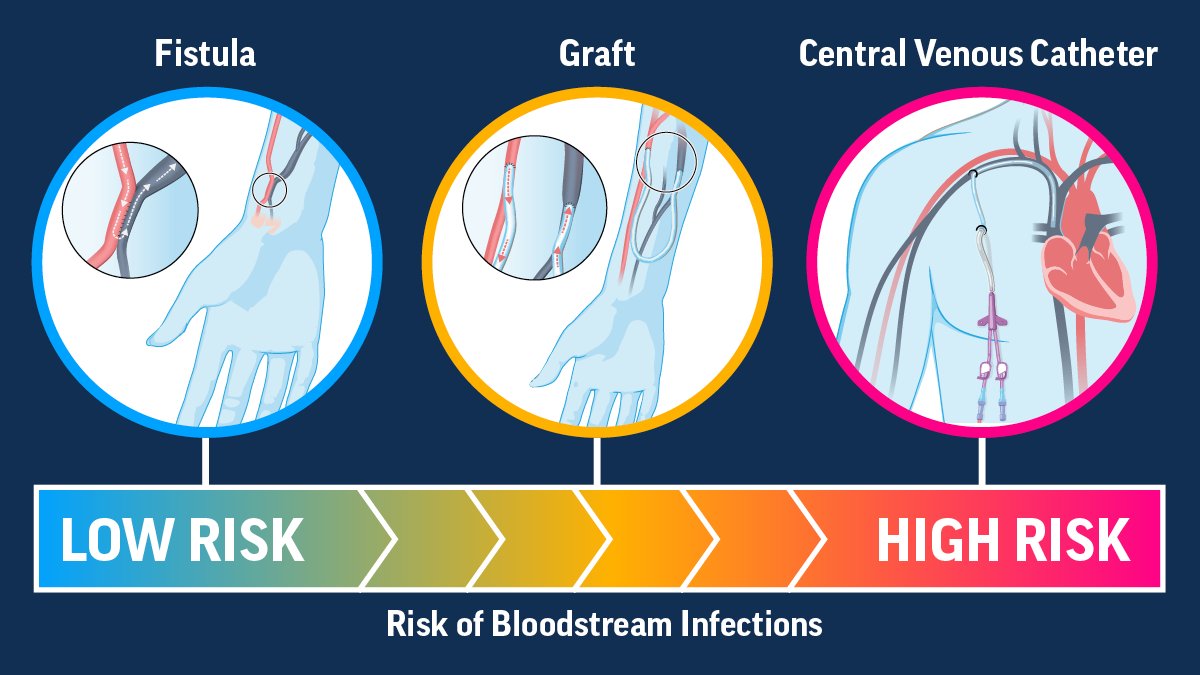 CDC Antimicrobial Resistance on Twitter "Reducing the use of central