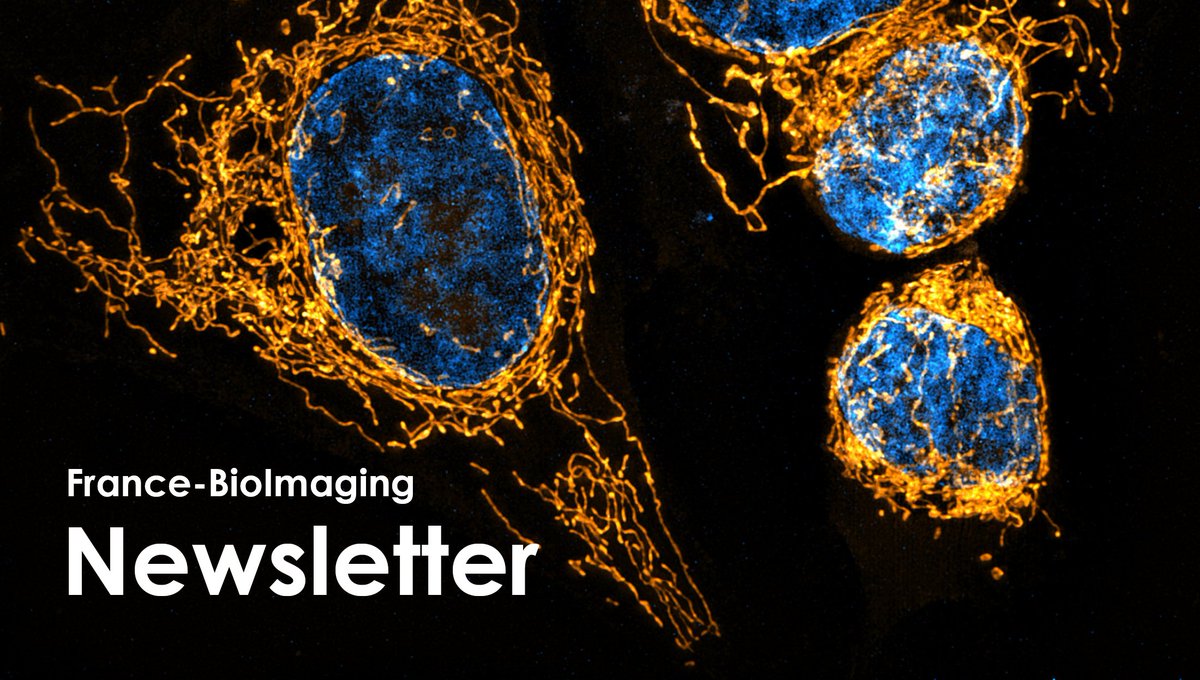 Fr_BioImaging's tweet photo. 📨This month's #newsletter is out! 

👉New calls for #funding, news from our core facilities... Learn more on: https://t.co/b3KzLBu5E0

🔬Mitochondria (HeLa cells) labelled with MitoTracker Red and imaged with Lattice SIM ©R. Lebars https://t.co/Ze9gZo3lGw