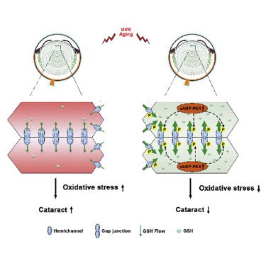 Another incredible #publication coming out from our group @iScience_CP “Protein Kinase A Activation Alleviates Cataract Formation via Increased Gap Junction Intercellular Communication” 👏🏼 #cataract #PKA #oxidativestress #hemichannel #lens #gapjunctions 
cell.com/iscience/pdf/S…