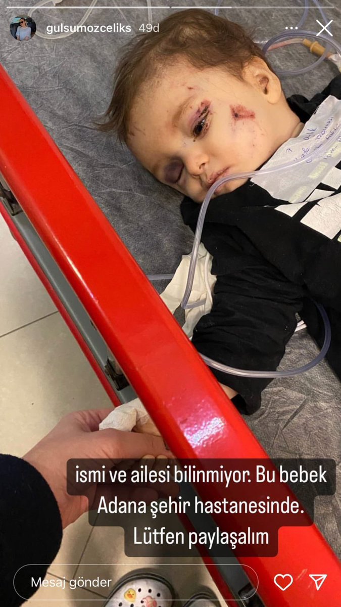 Kürşad BUCAK 🇹🇷 (@kursadbucak) on Twitter photo Adana şehir hastanesi
Yakınları görüp tanıyabilir 
Yayalım arkadaşlar Rt ile Adana şehir hastanesi
Yakınları görüp tanıyabilir 
Yayalım arkadaşlar Rt ile