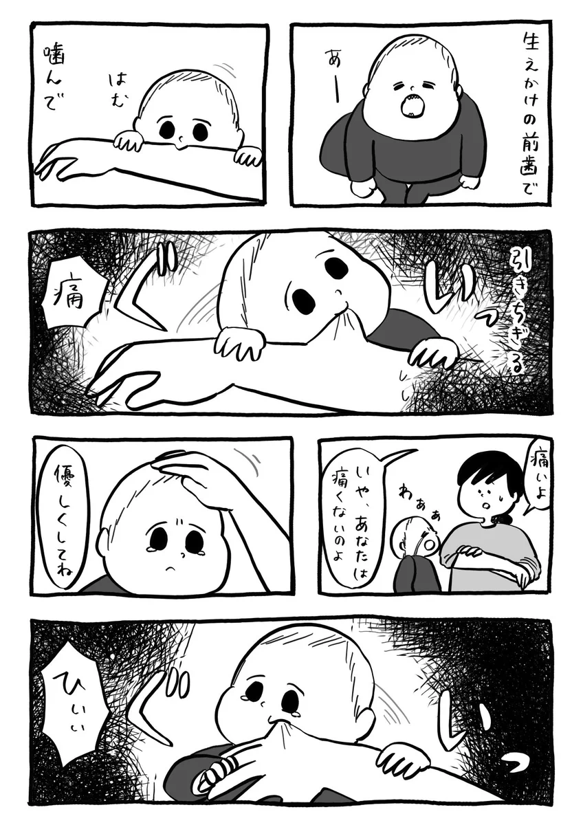 歯が生えたての乳児が危険？腕は歯型だらけ。