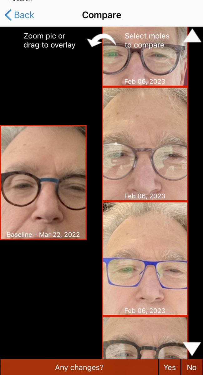 Finally found glasses that both pleased my wife, different, but aesthetically pleasing when compared with original pair.
#glasses #PHOTOS #HealthIT