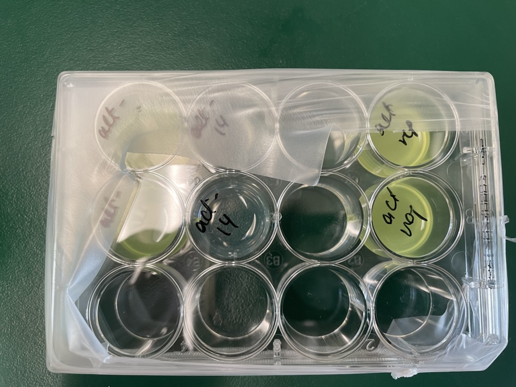 Hi twitter world, can someone tell me what contamination is this? these are fly S2 cells in M3 media with anti-anti and I only get it after FACS. 🫠