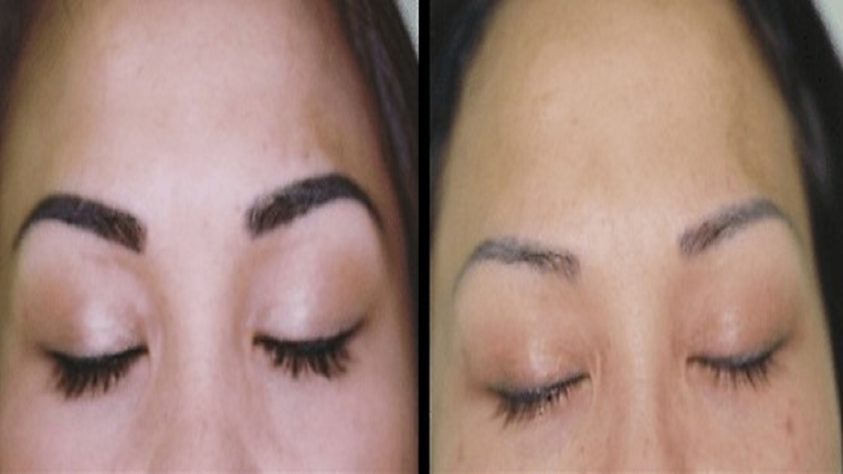'Erasing the Past: Say Goodbye to Regrettable Eyeliner Tattoos with Safe and Effective Removal Techniques.
For more info please visit at:tattoosketche.com/eyeliner-tatto….
#tattoo #eyelinertatto
#eyelinerart #eyelinertutorial 
#tattoosketch