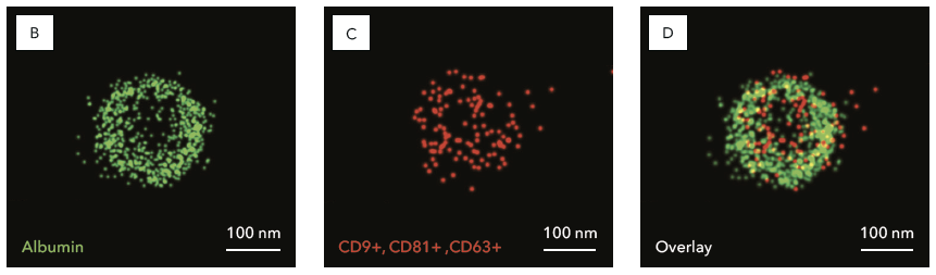 oniHQ's tweet photo. Learn how @Martin_Wolf1985 et al @paracelsus_uni used dSTORM to characterize the function of a protein corona associated with individual PLX stromal cell-derived EVs using the #Nanoimager. 

#ExtracellularVesicles #superresolution #singleEVimaging

https://t.co/hHZmor1pVJ https://t.co/TDaVxW02cr