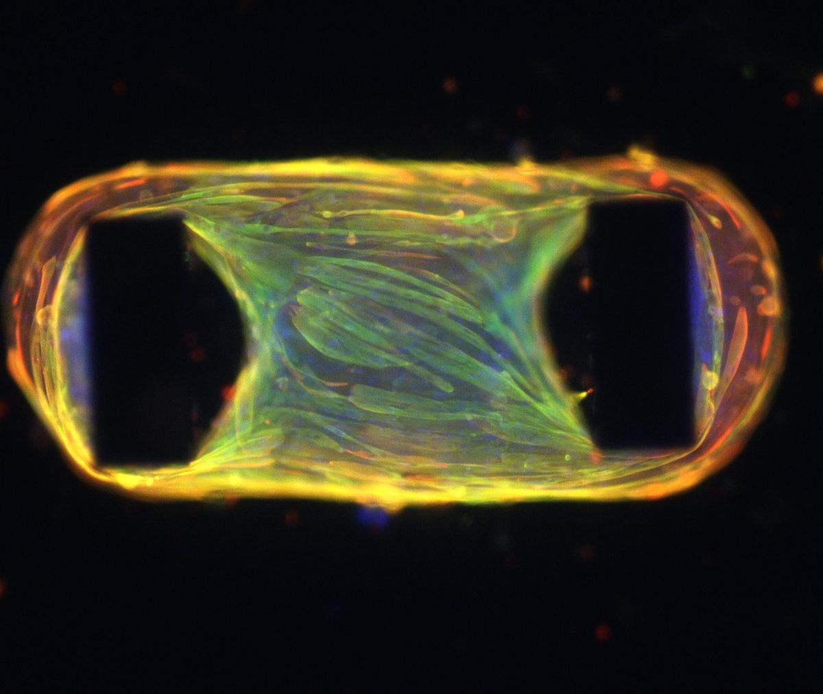 reNEW_Global's tweet photo. Skeletal #muscle allows you to move, breath, digest and more! Dr Richard Mills reNEW Melb is a leader in creating #bioengineered models of muscle in a dish as seen here, giving access to understanding debilitating muscle #diseases and exploring new #treatment options. #sciart https://t.co/GMwu4OsE6k