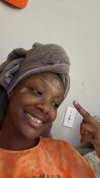 2 pic. 8 days apart, say cheeeese Deja ? https://t.co/xak2Q3RRwG