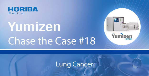 horibamedical's tweet photo. #ChaseTheCase 18 presents a case diagnosed with #LungCancer. Lung cancer is a possible cause of #lymphocytosis and #monocytosis due to the release of cytokines by tumor cells, which can activate the body's inflammatory response. Read more: https://t.co/cneTthfU0O https://t.co/YLEF6MmTg8
