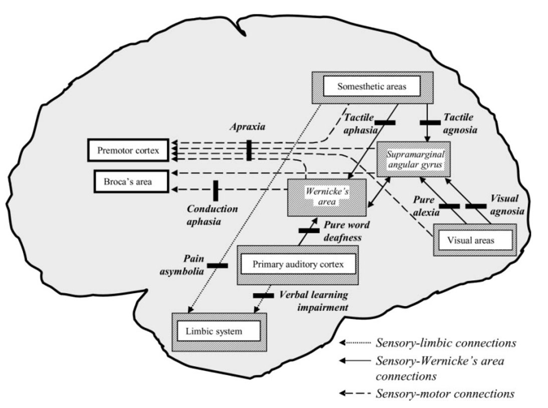 Dr_Prestegui's tweet photo. Síndromes de desconexión de Geschwind

Clásicos:
Afasia de conducción 
Alexia sin agrafia
Apraxia ideomotora
Agnosia visual 

Atípicos:
Asimbolia al dolor
Alteración en aprendizaje
Anomia tactil
Sordera de palabras puras
Anosognosia https://t.co/PoOLtONLPr