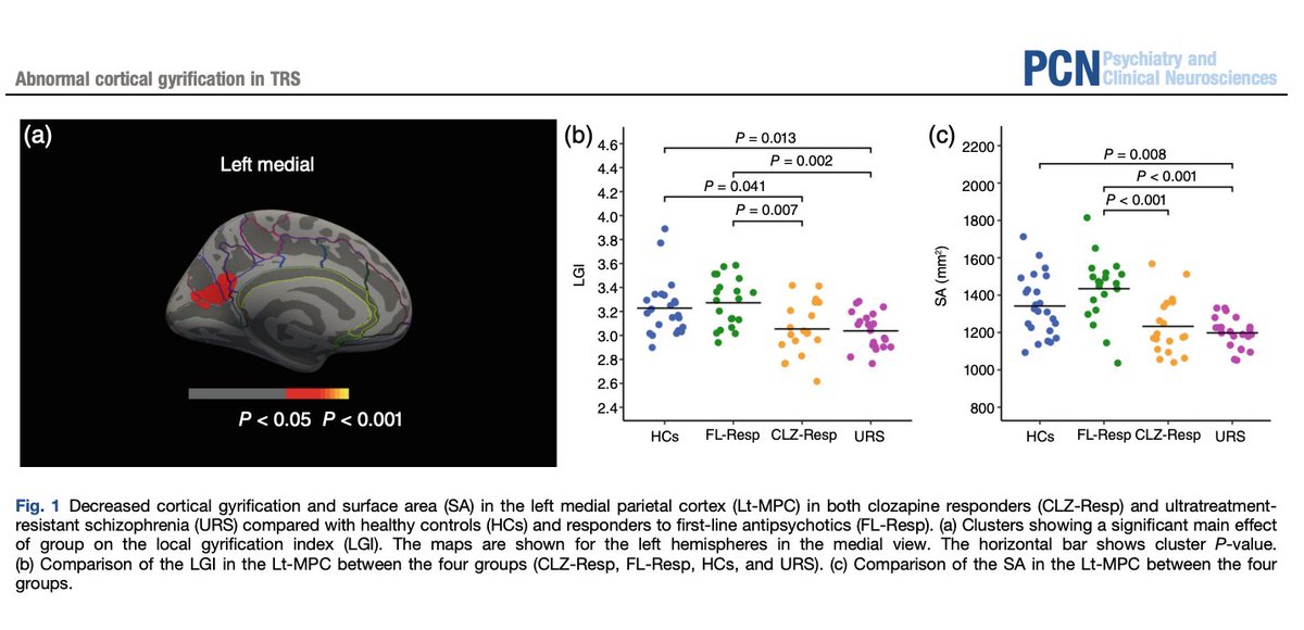 PCN_Psychiatry's tweet photo. Decreased cortical gyrification and surface area in the left medial parietal cortex in patients with treatment-resistant and ultratreatment-resistant schizophrenia
https://t.co/Kd3K73t9Ry
#gyrification #surface_area #treatment_resistant_schizophrenia #Schizophrenia #imaging https://t.co/5oTNzJ4RHh