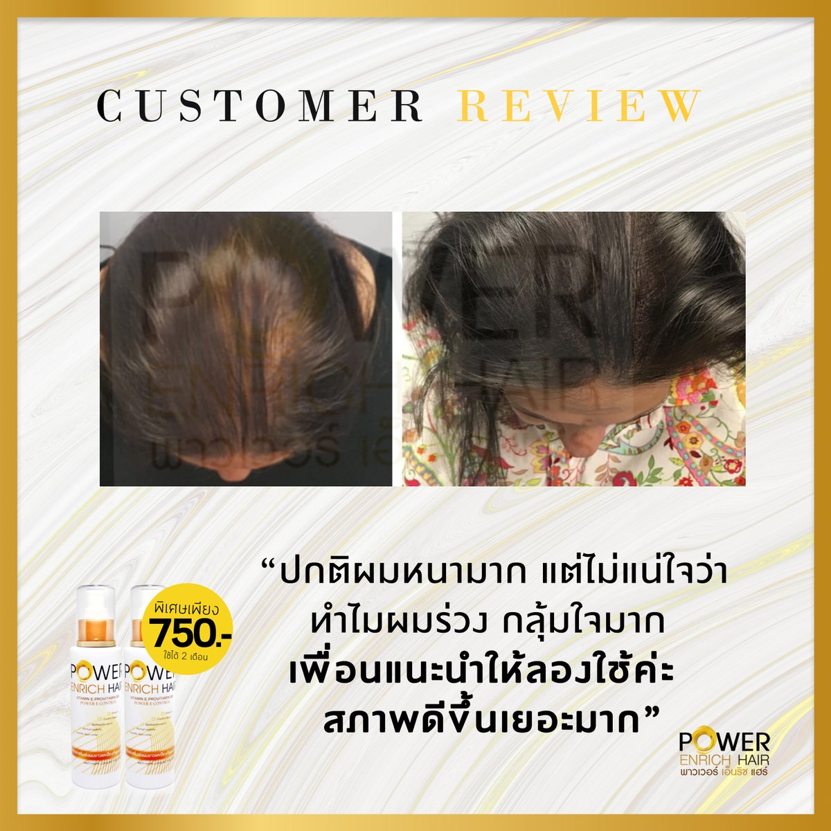 ปลูกผม ไรผม ผมร่วง เร่งผมยาว Power Enrich Hair tweet media