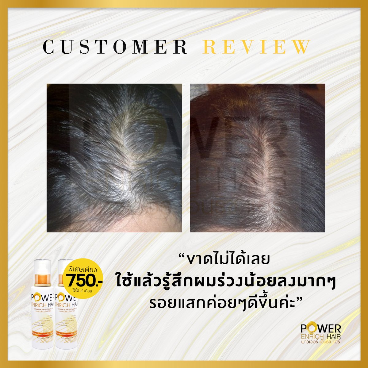 ปลูกผม ไรผม ผมร่วง เร่งผมยาว Power Enrich Hair tweet media