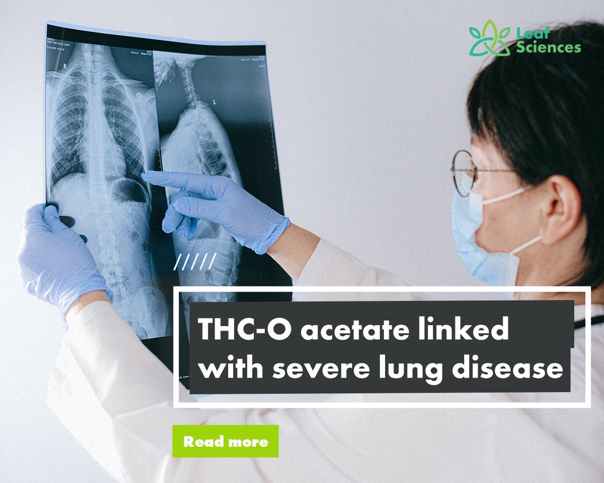 A study from the Journal of Medical Toxicology has linked smoking THC-O acetate with the potential to trigger severe lung disease.

This article from <a href="/MJBizDaily/">MJBiz</a> explains more: ow.ly/2KsE50MSCk1

#THC #cannabis