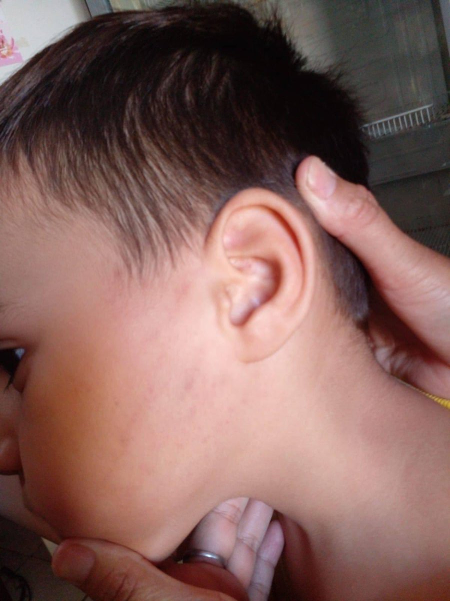 Está es la historia de Kevin Gorosito de 4 años de la calle Uspallata 520 Barrio Sargento Cabral , Santiago del estero capital, un niño que está teniendo una infancia muy fea por culpa de su padre adicto Mariano Gorosito, hoy fue uno de esos tantos días donde Kevin recibió maltra
