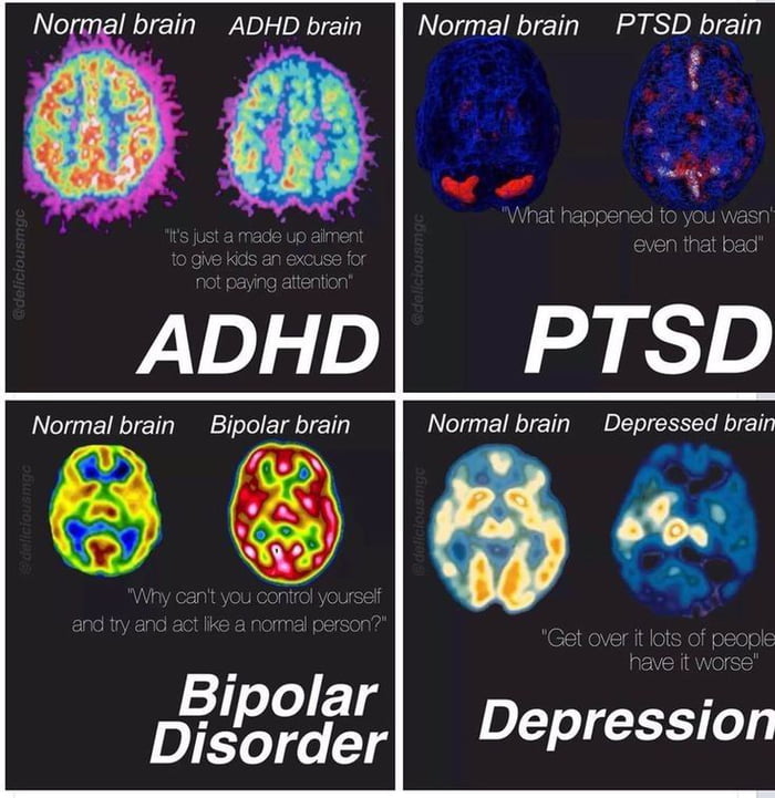 agung_barbel's tweet photo. @tanyarlfes bipolar, schizophrenia, depresi, delusi, mental illness, periksakan ke dokter, dan psikiater, ato ke psikolog dulu sebelum ke psikiater. https://t.co/4QdVnkdpYJ