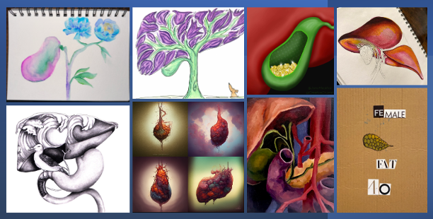 ASGBI_MA's tweet photo. So how to reap these benefits?
Say Yes! - try new experiences
Listen and value others opinions
Be humble
Recognise your affinity bias and challenge it
Find common ground
We love the work of #wpac using art and medicine to bring together different perspecpectives #gallbladders https://t.co/XEqMSMTgkm