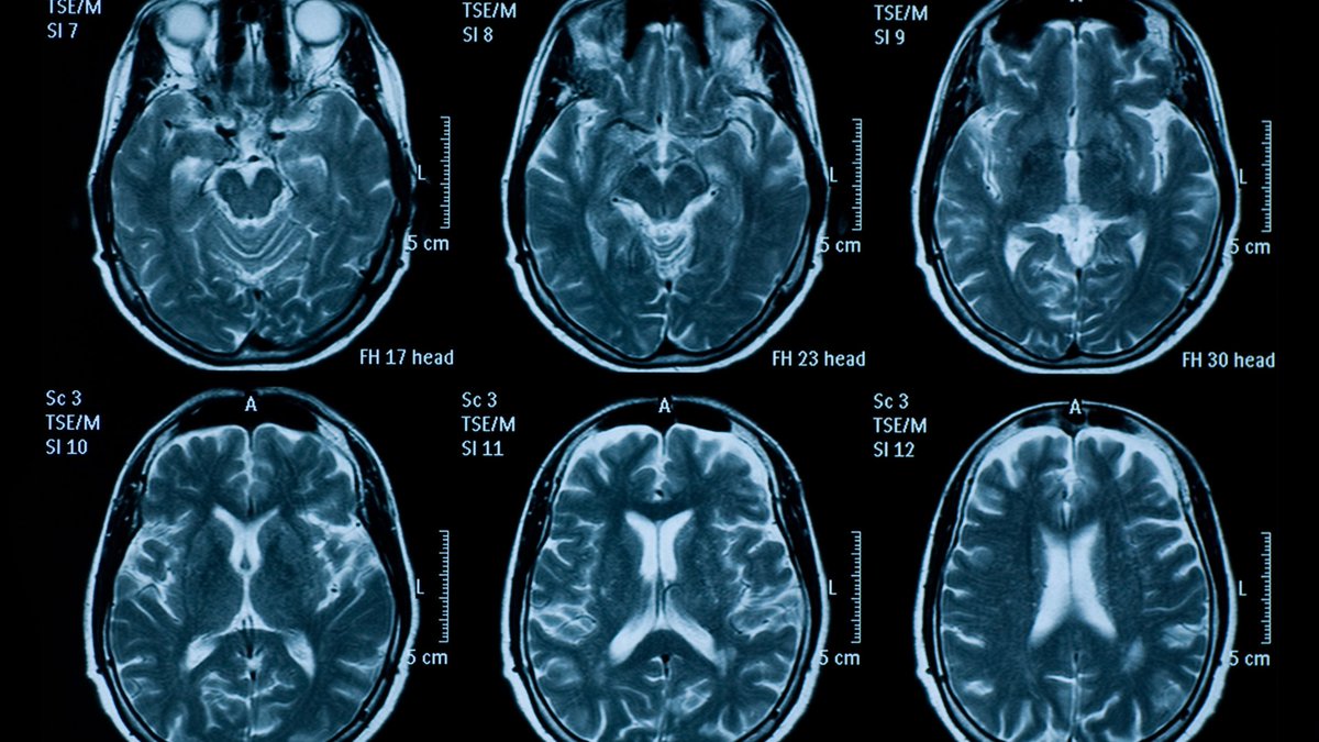 Population Data Science at Swansea University tweet media