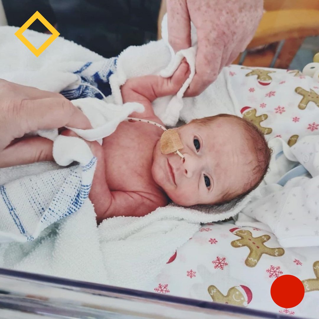 Μια πρόωρη γέννα είναι πάντοτε δύσκολη, τόσο για τους γονείς όσο και για το παιδί, αφού συχνά ακολουθείται από επίμονα προβλήματα υγείας.

Το ίδιο συνέβη και στην περίπτωση του μικρού Stanley, ο οποίος γεννήθηκε πρόωρα κατά 37 ολόκληρες βδομάδες.

📷: RMHC UK

#TinySuperheroes