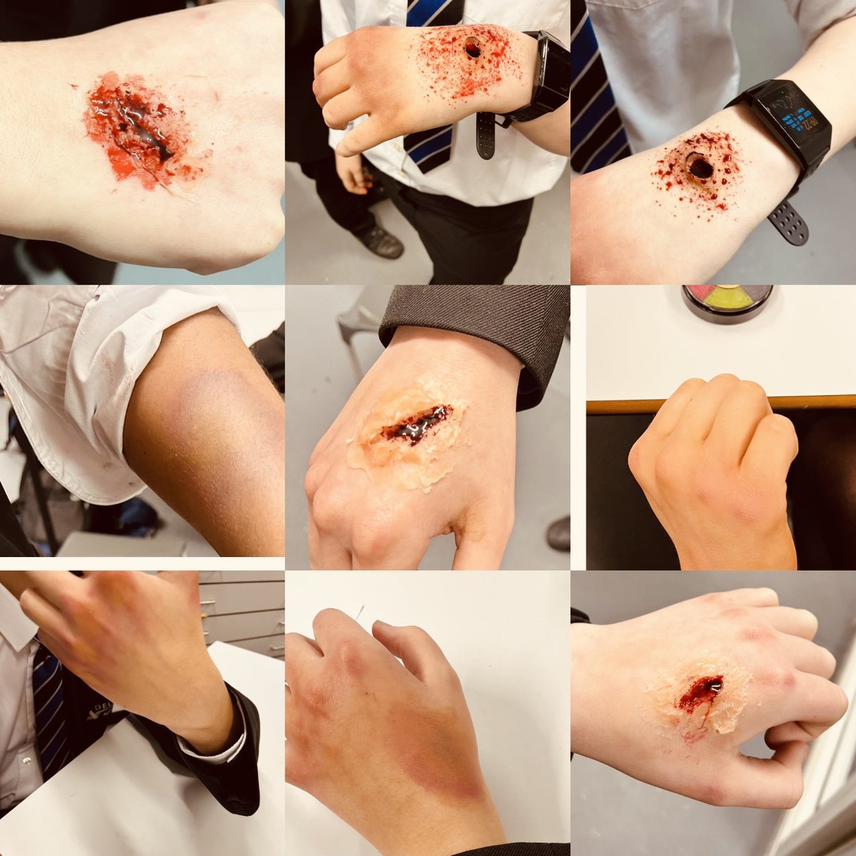 DeltaDonValley's tweet photo. Y9 Drama students explore SFX make-up to create bruises, cuts and grazes for Oggy Moxon in their last lesson exploring the play 'Teechers' #TeamDVA #SFX #Designoption #DesigninDrama https://t.co/jktFgSvIJF