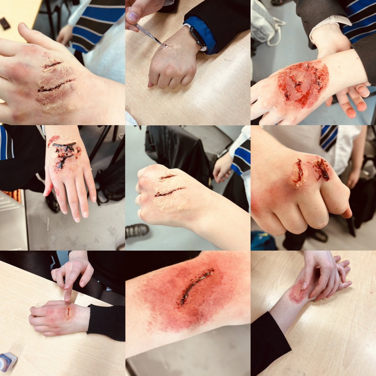 DeltaDonValley's tweet photo. Y9 Drama students explore SFX make-up to create bruises, cuts and grazes for Oggy Moxon in their last lesson exploring the play 'Teechers' #TeamDVA #SFX #Designoption #DesigninDrama https://t.co/jktFgSvIJF