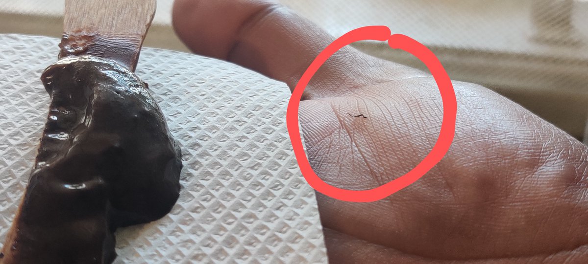 kumar_ridhima's tweet photo. Hi @BaskinRobbins @BaskinRobbinsIn , I had purchased Mississippi Mud ice cream from MK retail store in Bangalore last week. I had almost finished the ice cream and then I felt something poking in my mouth. I noticed, it was piece of metal. (see attached image), @fssaiindia https://t.co/0QDDpafXTR