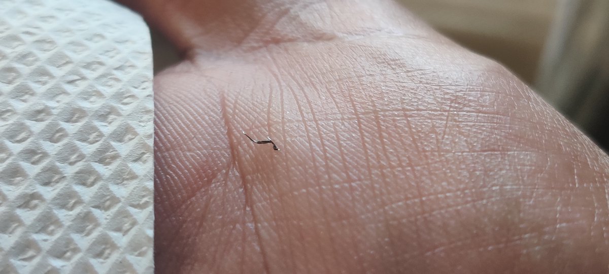kumar_ridhima's tweet photo. Hi @BaskinRobbins @BaskinRobbinsIn , I had purchased Mississippi Mud ice cream from MK retail store in Bangalore last week. I had almost finished the ice cream and then I felt something poking in my mouth. I noticed, it was piece of metal. (see attached image), @fssaiindia https://t.co/0QDDpafXTR