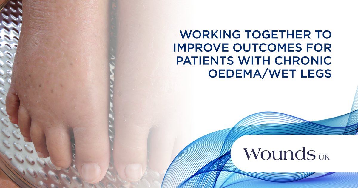 Wounds UK on Twitter "Chronic oedema is a condition that worsens with